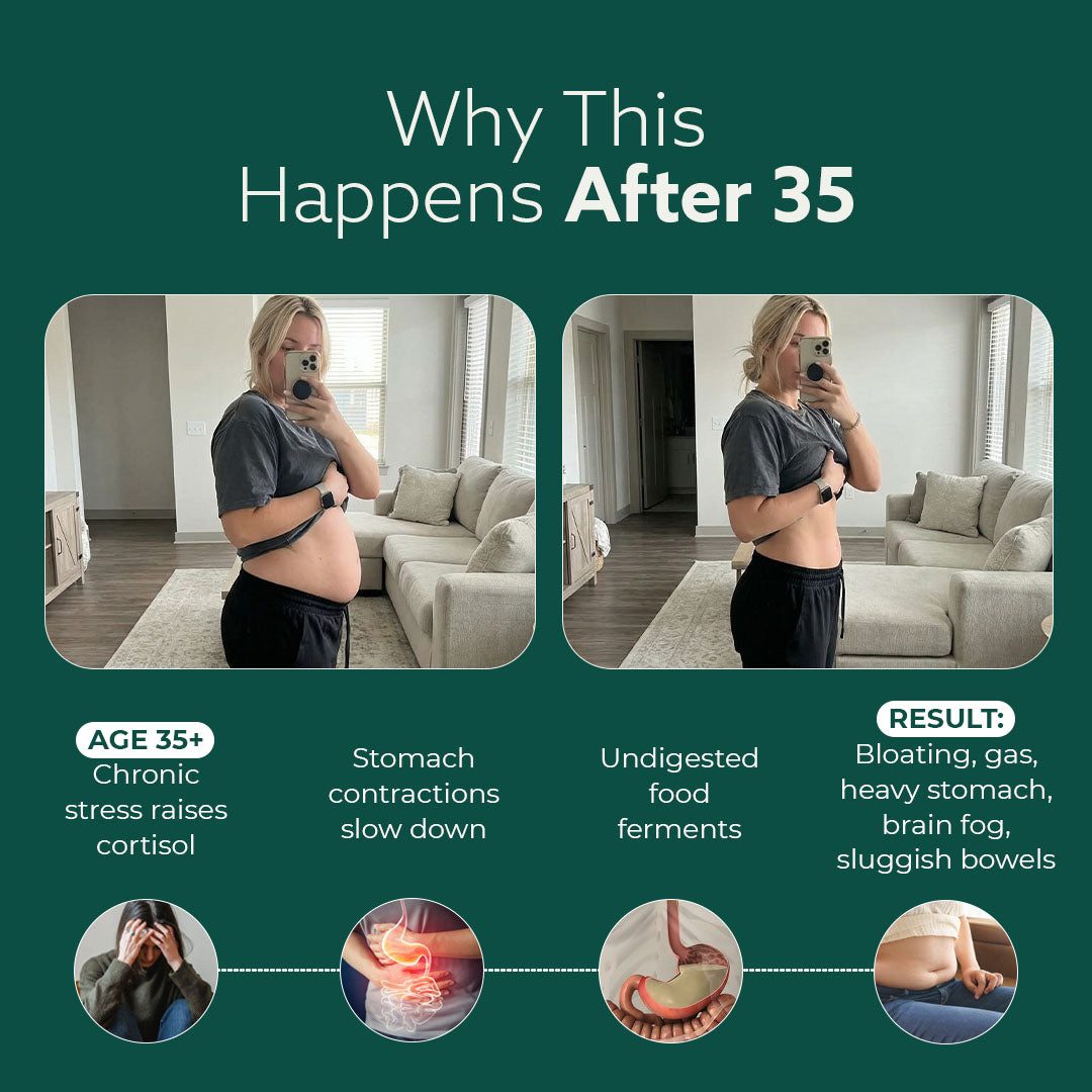 New Maximum Potency Formula - Premium Gut Support by Sculptique™