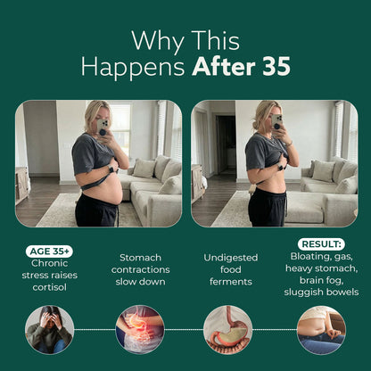 New Maximum Potency Formula - Premium Gut Support by Sculptique™